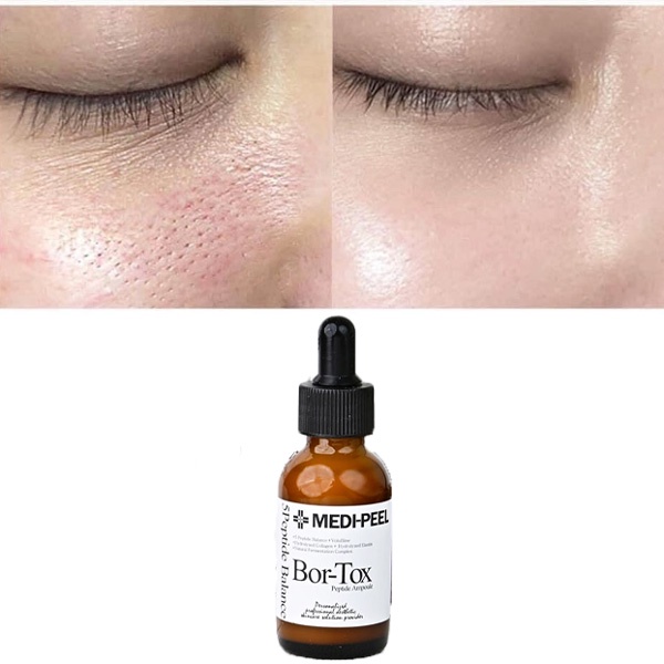 Tinh Chất Căng Bóng Da  MEDI-PEEL Bor-Tox Peptide Ampoule Medi Peel Bortox 30ml