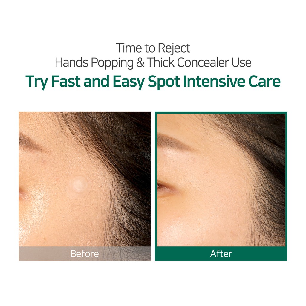 Miếng Dán Mụn Some By Mi Clear Spot Patch