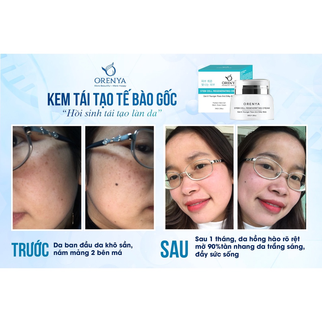 Kem Tái Tạo Tế Bào gốc - Phục Hồi Các Tế Bào Da Hư Tổn🌱 Làm Mờ Sẹo Rỗ, Sẹo Do Mụn