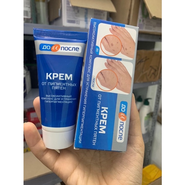 Kem Tay Kpem  Đồi Mồi, Vết Nám, Sạm, Đốm Nâu Da Tay