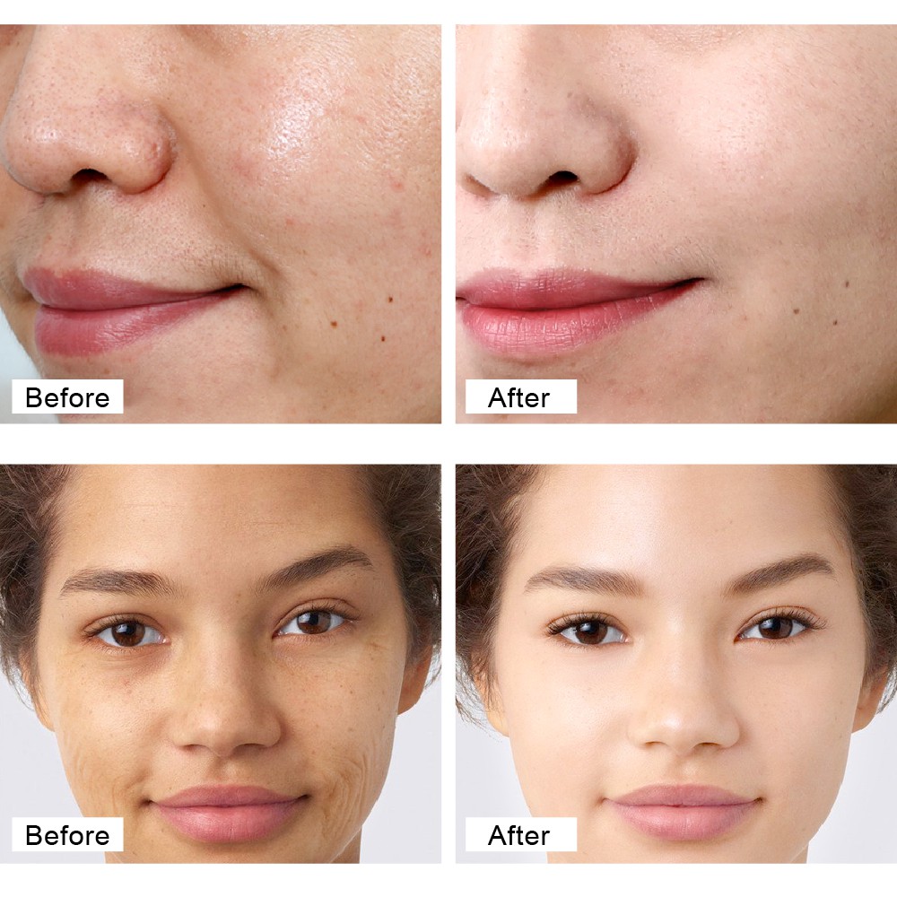 Bộ kem dưỡng mặt retinol VIBRANT GLAMOUR + serum mắt retinol làm săn chắc collagen chống nhăn dưỡng ẩm cao cấp