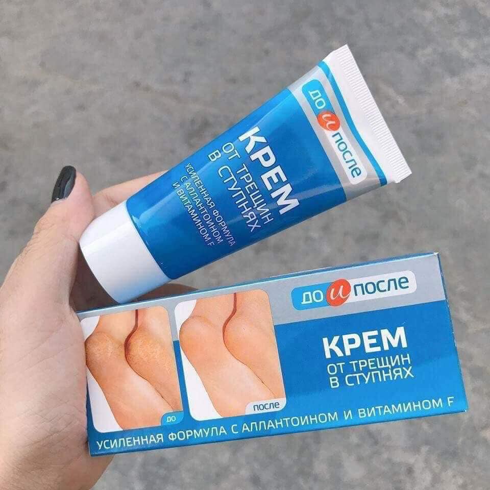 Kem Trị Nứt Nẻ Gót Chân Kpem Apteka Nga 50ml