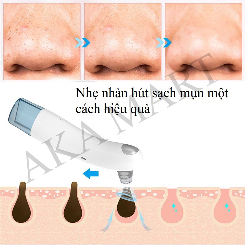 Máy hút mụn mini cầm tay chính hãng cao cấp B68 2021, máy hút mụn cẩm tay mini công nghệ oxy loai tốt