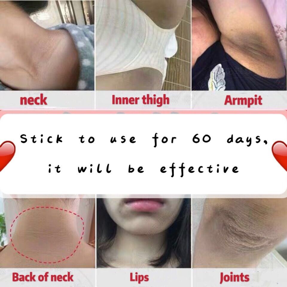 Kem Làm Trắng Da Vùng Dưới Cánh Tay / Đầu Gối / Chân 70g