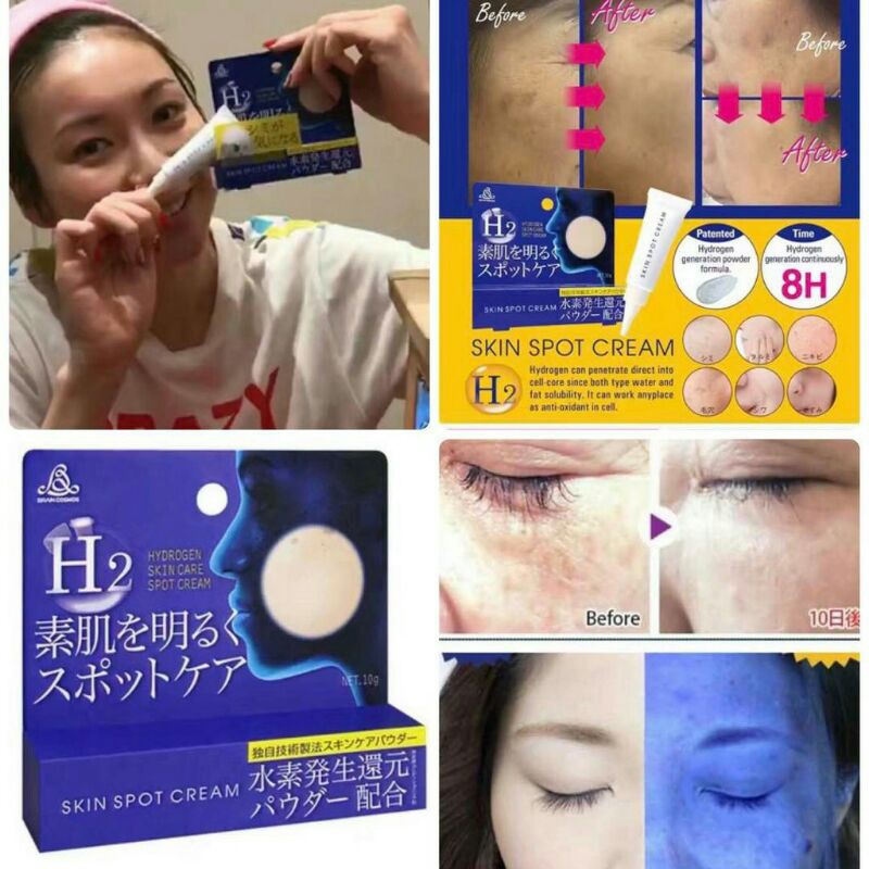 h2 skin spot cream