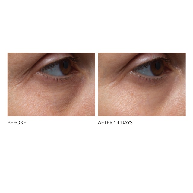 Serum mắt Dr Dennis Gross Ferulic+ Retinol Triple Correction Eye Serum | BigBuy360 - bigbuy360.vn
