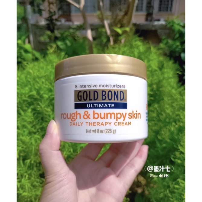 Kem Dưỡng Gold Bond Ultimate Rough & Bumpy Skin