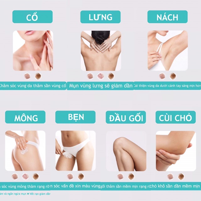 NAKIZ LIVELY BUTT 〡 Kem thoa thâm, mụn Mông, Bẹn, Nách, Lưng, Nhũ hoa, Cùi chỏ, Đầu gối .... Thái Lan | BigBuy360 - bigbuy360.vn