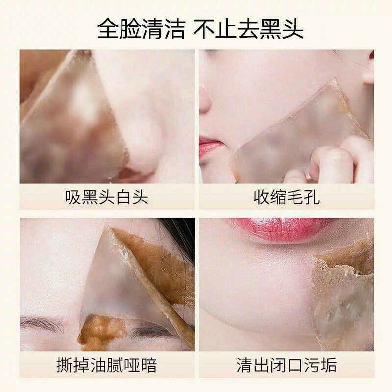 Gel lột mụn Skin Care