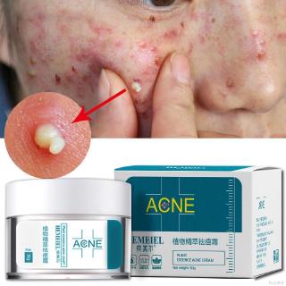 [Hàng mới về] Kem dưỡng ẩm da mặt chống sẹo mụn loại bỏ mụn đầu đen se khít lỗ chân lông