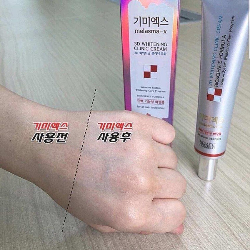 Kem dưỡng da mờ thâm nám tàn nhang Melasma-x 3D Whitening Cline Cream 35ml Auth Hàn Quốc kem nám 3D