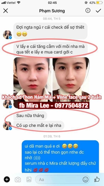 Tinh Chất Thu Xương Vline Face Hàn Quốc