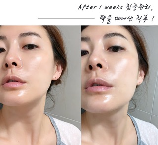 MẶT NẠ CAO CẤP DERM ALL MATRIX MẪU MỚI
