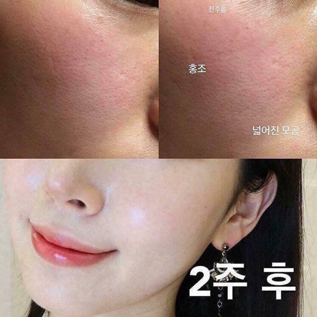 Serum Ped feel hàn quốc