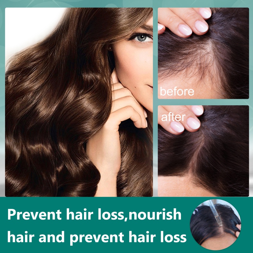 Tinh Chất Kích Thích Mọc Tóc Tự Nhiên 30ml