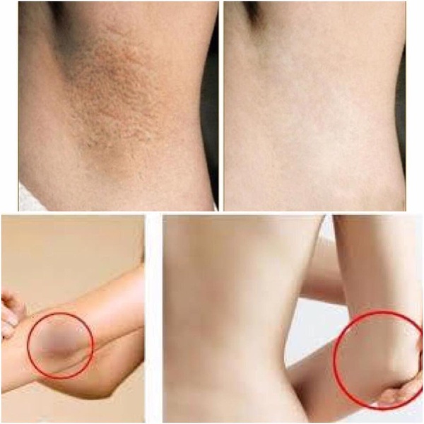 Kem dưỡng Vacosi giảm thâm sáng da vùng nách Whitening Armpit Cream 30ml