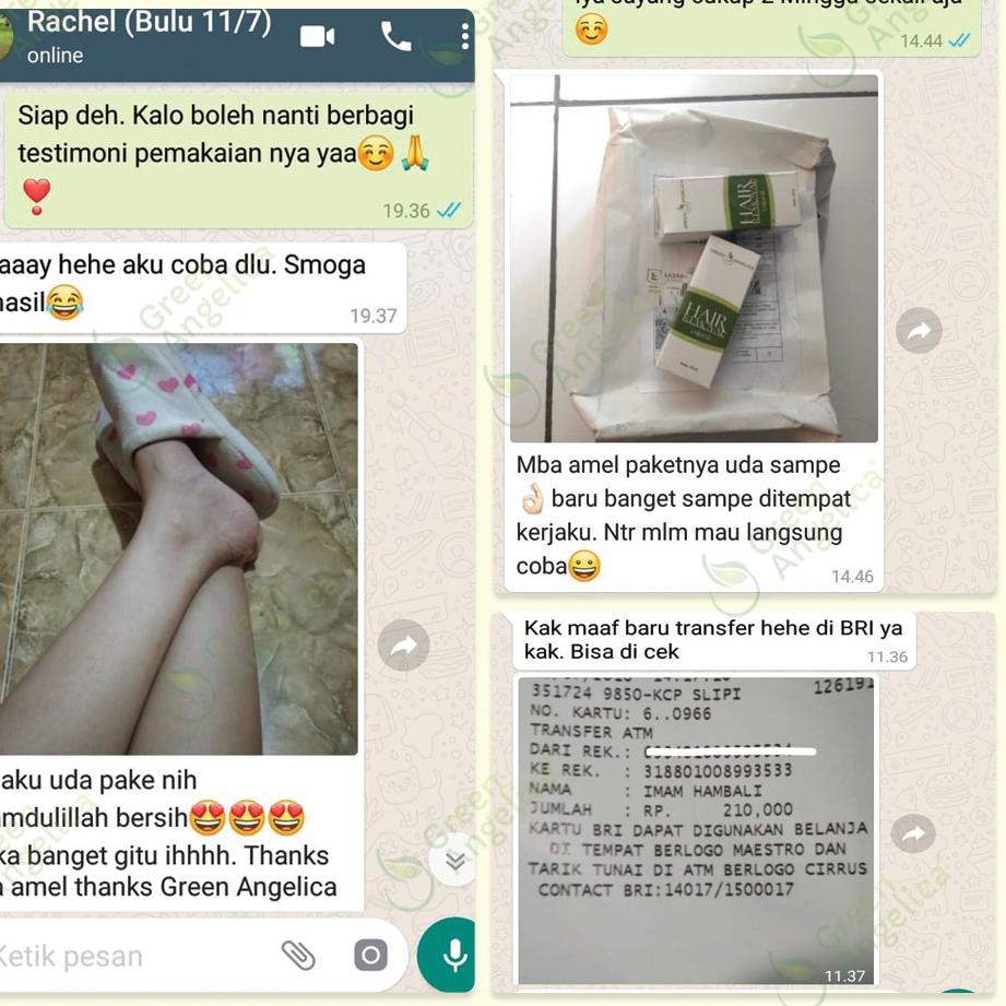 (Hàng Mới Về) Set 567 Dụng Cụ Tẩy Lông Vĩnh Viễn Không Gây Đau Đớn Tiện Dụng | BigBuy360 - bigbuy360.vn