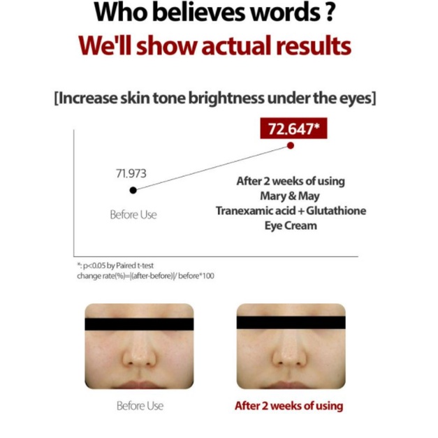 Kem Mắt Hỗ Trợ Giảm Quầng Thâm Mary & May Tranexamic Acid+ Glutathion Eye Cream 30ml