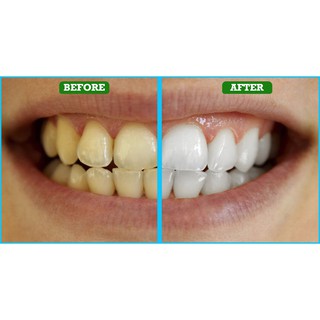 COMBO/Bộ 2 tuýp kem đánh răng Oral_B White