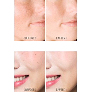 Che Khuyết Điểm Karadium Skin Perfection concealer