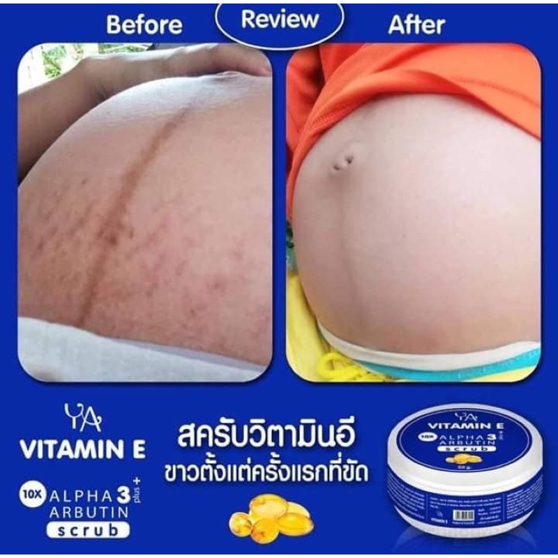 👶 XOÁ RẠNG DA - TẨY TẾ BÀO CHẾT VITAMIN E (Face và Body) 🇹🇭