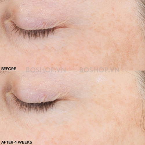 Tinh Chất Timeless 20% Vitamin C Serum Giảm Thâm Dưỡng Trắng Da