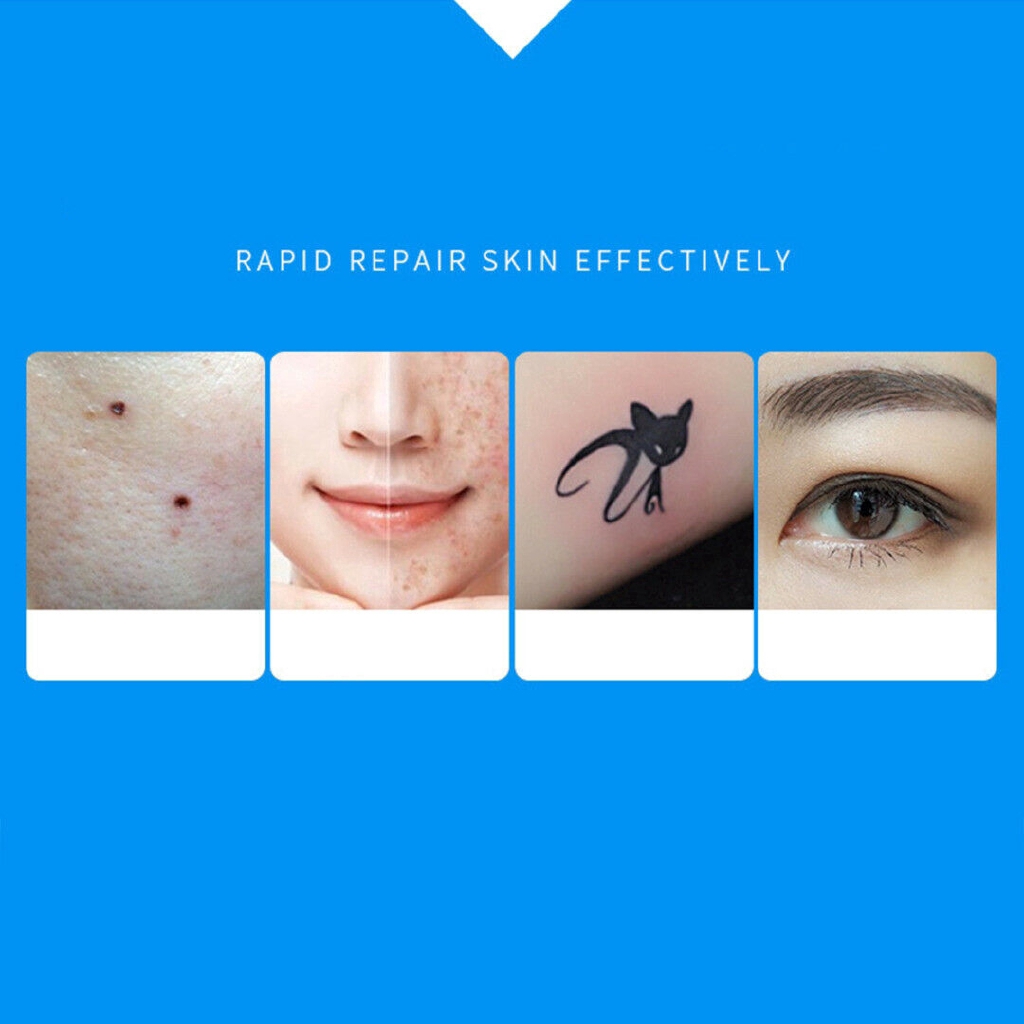 [Hàng mới về] Kem lô hội xóa tàn nhang không gây đau an toàn cho da