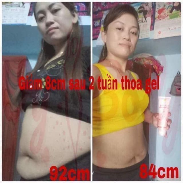 KEM MASSAGE TAN MỠ BỤNG VY&BODY