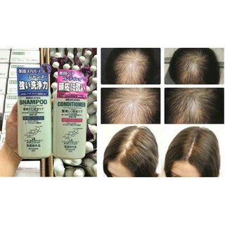 Dầu gội, Xả kích thích mọc tóc Kaminomoto Medicated Shampoo