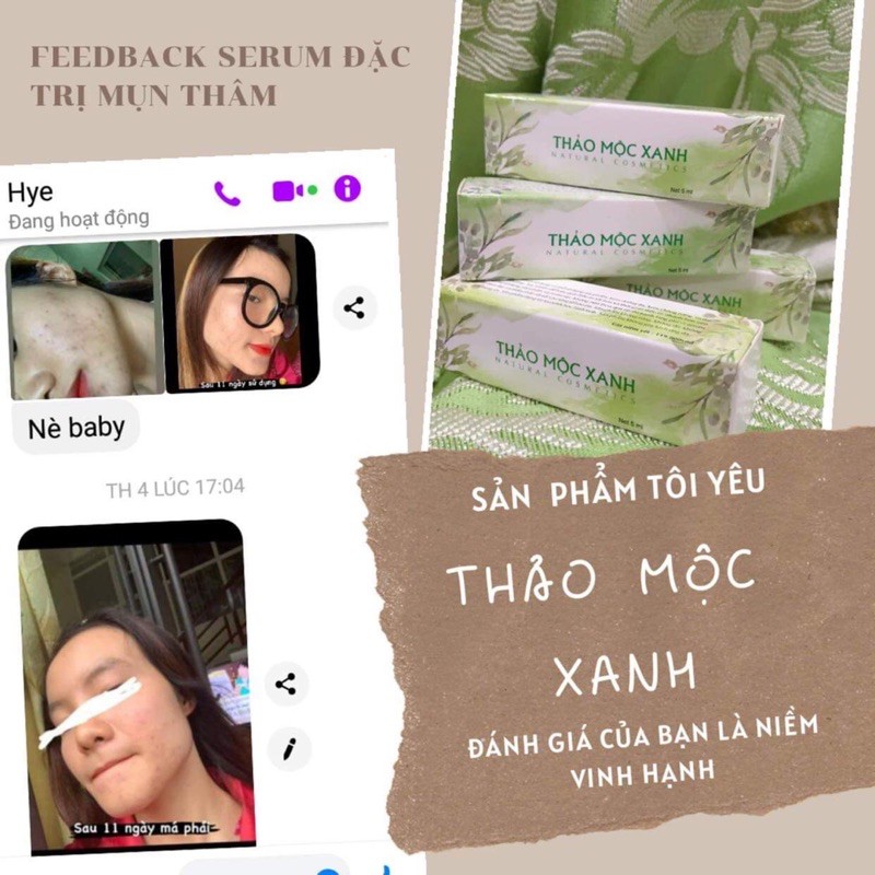 Serum thảo mộc xanh 💥FREESHIP💥 | BigBuy360 - bigbuy360.vn