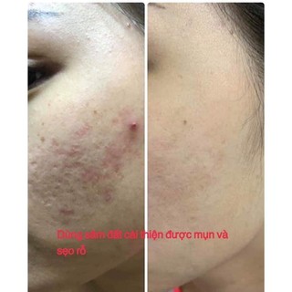 Tinh Chất Sâm Đất - Thảo Mộc Hàn