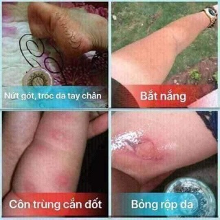 Mỡ trăn