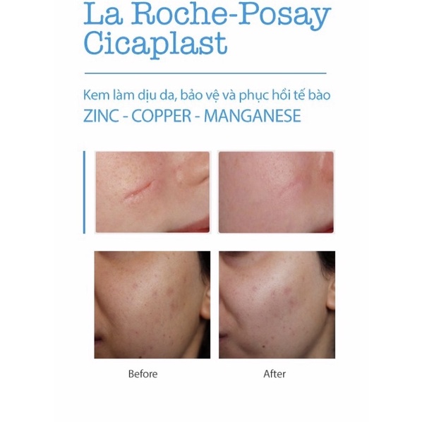 GEL B5 Laroche posay PHỤC HỒI DA -GIẢM THÂM MỤN