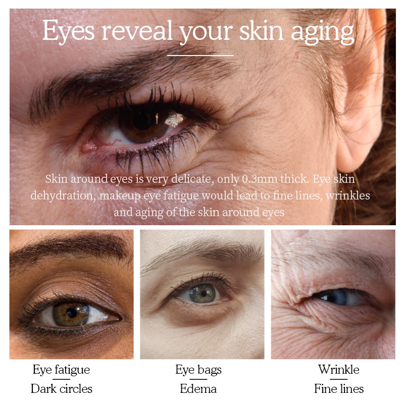 Set 30 cặp mặt nạ mắt Retinol Hydra-Gel Vibrant Glamour Collagen Hyaluronic Acid dưỡng ẩm chống lão hóa xóa quầng thâm | BigBuy360 - bigbuy360.vn