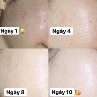 Kem dưỡng phục hồi Avene Cicalfate