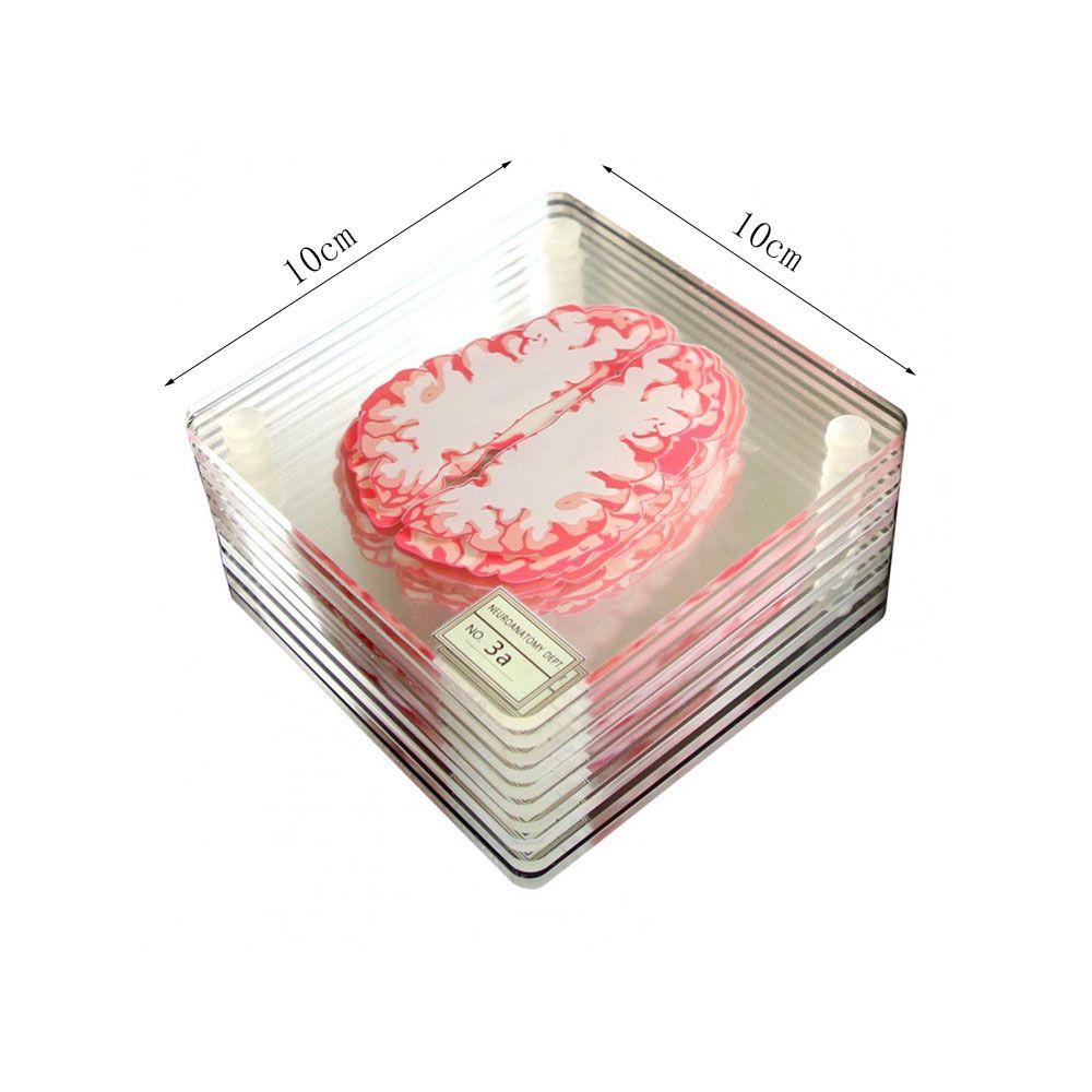 Lloyd Bộ Đế Lót Cốc Bằng Acrylic Hình Lát Lát Nghệ Thuật Dành Cho Quán Bar / Nhà Ở