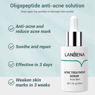(Hàng Mới Về) Serum Trị Mụn Lanbena 30ml Cao Cấp