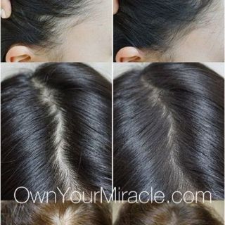SẢN PHẨM CHE KHUYẾT ĐIỂM CHÂN TÓC