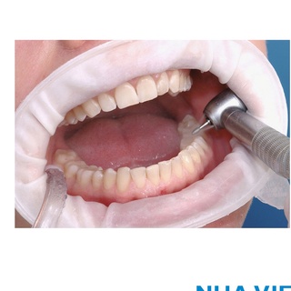 Banh miệng tẩy trắng răng spa,banh miệng cao su nha khoa