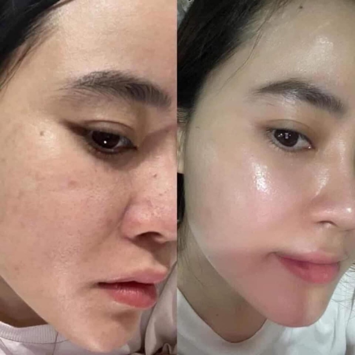 Retinol K Lady Care 0.5% 30ml Hàn Quốc, Kem Dưỡng Da Retinol Giữ Ẩm Căng Bóng Tái Tạo Da Mặt