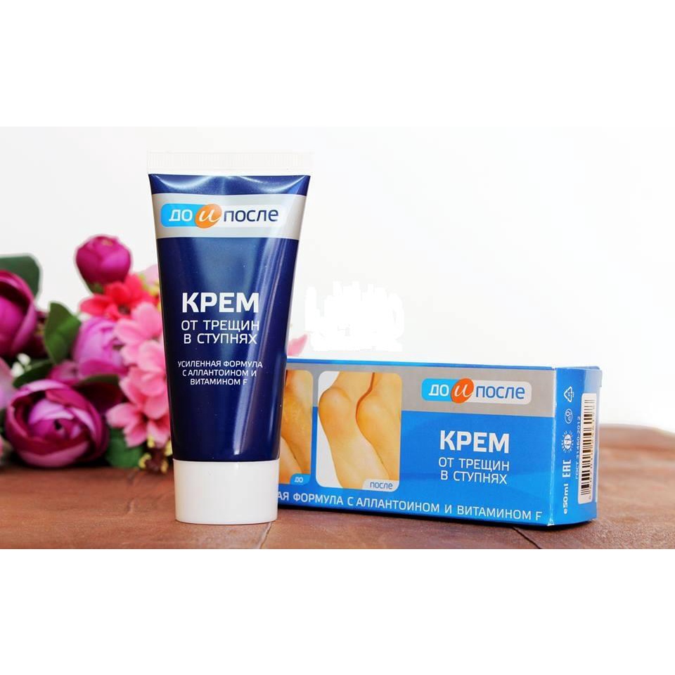 Kem Ngăn Ngừa Và Hồi Phục Nứt Nẻ Gót Chân Kpem Nga [50ml]