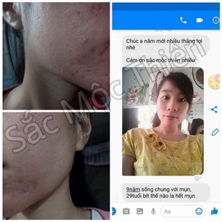 Tinh chất tái tạo cao cấp 30ml Sắc Mộc Thiên