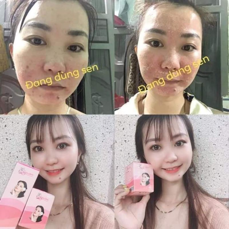 Combo Serum Thảo Dược + Bột Thảo Mộc Sen Spa Mẫu Mới