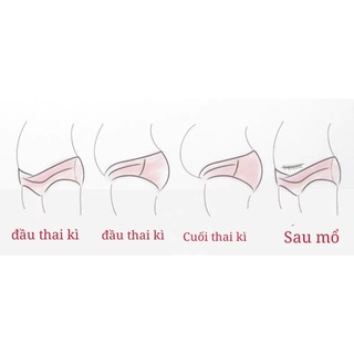 Quần chip bầu đúc