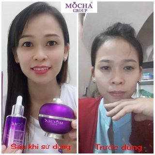 Kem face vip tuyết sứ juky