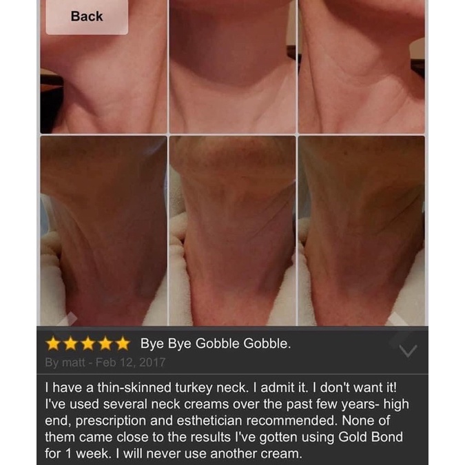 Kem dưỡng săn da cổ, vùng dưới cổ Gold Bond fullsize 56g