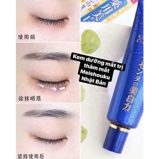 KEM MẮT MEISHOKU NHẬT BẢN 30ml