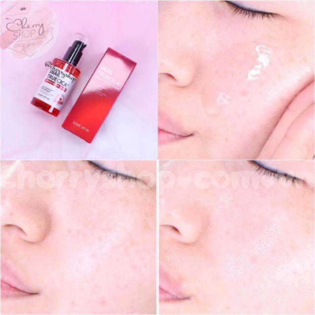 Tinh chất làm mờ sẹo, dưỡng trắng some by mi snail truecica miracle repair 50ml | BigBuy360 - bigbuy360.vn
