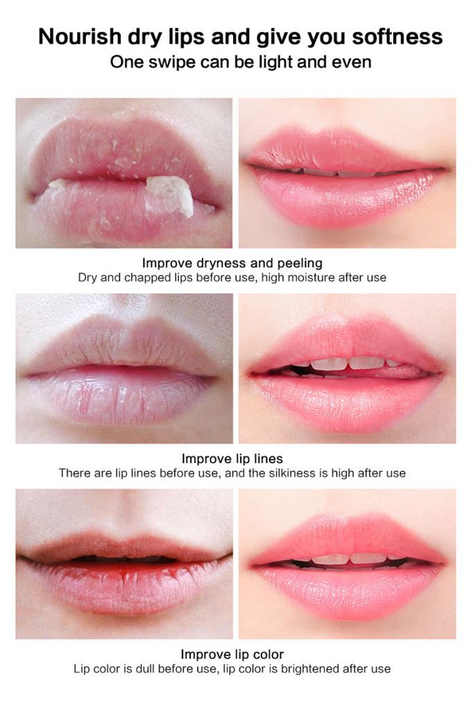 [Hàng mới về] Mặt nạ môi không màu phục hồi giữ ẩm làm môi căng mọng chống nứt nẻ và mờ đường viền môi | BigBuy360 - bigbuy360.vn