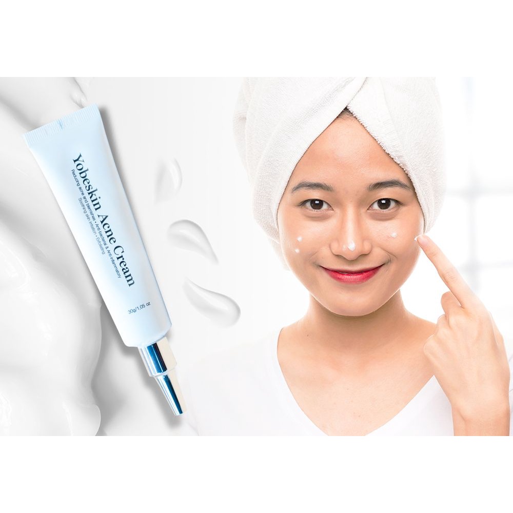 Kem ngăn ngừa mụn giảm thâm nám YOBE dưỡng sáng da, Soti | BigBuy360 - bigbuy360.vn
